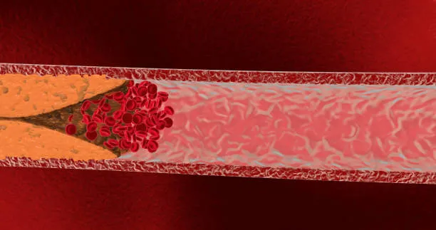 info-612-323 info-612-323